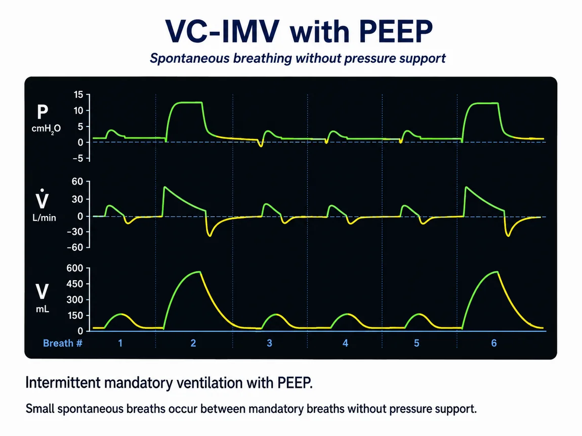 VC-IMV with PEEP